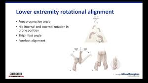 Image result for Foot Progression Angle
