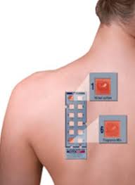 Image result for Patch Testing