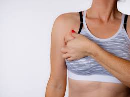 A relatively large segment of clavicle (yellow dotted lines) is lucent with irregular margins and a wide zone of transition. Signs Of Breast Cancer