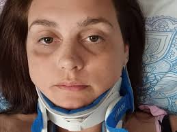 Fundraiser by Robin McNicoll : Help Louise with Life Changing Spinal Surgery