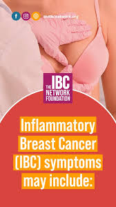 Image result for Inflammatory breast cancer