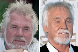 While you may not notice it initially, it can eventually impact your vision. Male Plastic Surgery Gone Awry