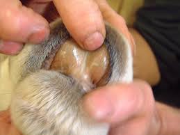 Image result for Copper Poisoning