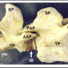 Truncal vertebrae (divided into thoracic and lumbar vertebrae in mammals) lie caudal (toward the tail) of cervical vertebrae. Pdf Morphometry Of Cervical Vertebrae Of Camel Camelus Dromedarius
