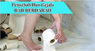 Penyebab buang air besar berdarah bisa terjadi karena penyakit seperti wasir, fisura ani, atau bahkan sembelit. Bab Berdarah Alami Medium