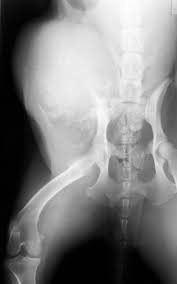 What are the symptoms of bone cancer? St8prrogg4q 0m