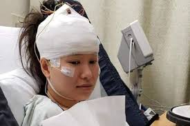 Fundraiser by Ngoc Qui Phan : My sister's brain surgery