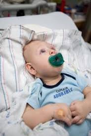 The amazing story of the baby born with his brain outside his skull