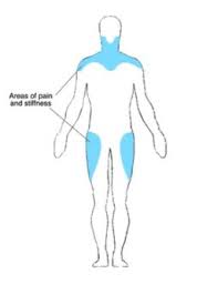 Image result for Polymyalgia Rheumatica