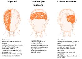 Image result for Acute Localized Headache
