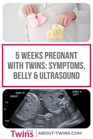 Pin On About Twins Blog Posts