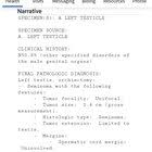 Knowing the signs of testicular cancer will help with early detection of the disease. Ejm Moxua51b2m