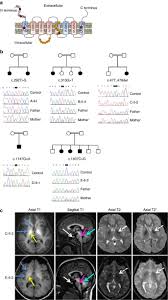 2.8k likes · 2 talking about this · 1 was here. Mutations In Slc39a14 Disrupt Manganese Homeostasis And Cause Childhood Onset Parkinsonism Dystonia Nature Communications