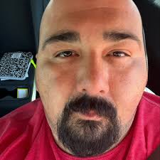 Yesterday's crash in Stockton.