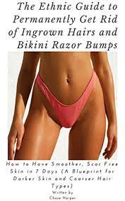 They occur when cut hairs start to grow back down into the skin rather than growing out above. The Ethnic Guide To Permanently Get Rid Of Ingrown Hairs And Razorbumps How To Have Smoother Scar Free Skin In 7 Days By Chase Harper