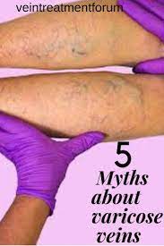 Pin On Vein Treatment
