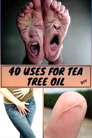 Tea Tree Oil Is More Useful Than You Think Here Are 40 Reasons You Need It At Home In 2020 Diy Life Hacks Hacks Diy Diy Bath Products