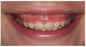 Smile Gallery