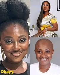 Sad 💔🥲 A fatal car accident occurred earlier this morning involving  Nigerian rapper ODUMODUBLVCK, who has been hospitalized with severe  injuries. We urge everyone to offer their prayers and support during this