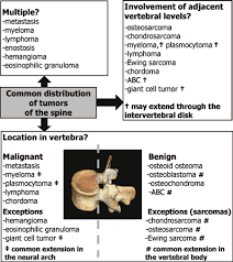 chart shows the common distribution of tumors of the spine