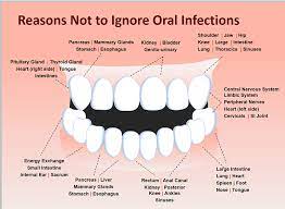 Periodontal Disease Gingivitis Mild Periodontics Moderate Periodontics Advanced Periodontics Periodontal Disease Periodontitis Dental Facts