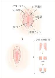婦人科形成 | 美容外科、婦人科形成の東京のモティーフ銀座クリニック