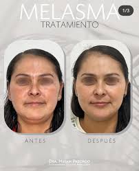 Dra. Miriam Sarahi Preciado Aguiar Dermatólogo, Guadalajara