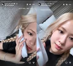 Rose BLACKPINK Pamer Hasil Rontgen