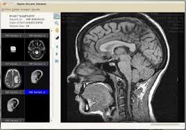 We did not find results for: Top 12 Free Open Source Dicom Viewers And Pacs Workstations For Macos