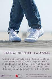 Pin On Women And Blood Clots