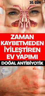 Zaman Kaybetmeden Iyilestiren Ev Yapimi Dogal Antibiyotik Natural Medicine Medicine Medical