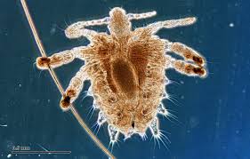 Image result for pubic lice symptoms