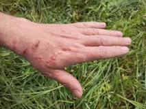 Image result