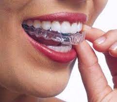 Retainers keep teeth in place after braces or correct small orthodontic issues. Wearing Retainers Do You Understand Why Moss Wall Orthodontics Lacey Wa