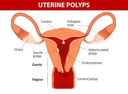 Asing fungsi klinik, farmasi kawal harga ubat via www.sinarharian.com.my. Cuci Rahim Bantu Bersihkan Lapisan Uterus Lepas Keguguran