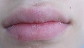 Auslöser ist meist der herpes typ 1 (herpes sim­­plex). Ist Herpes Im Heilstadium Noch Ansteckend Gesundheit Sexualitat Haut