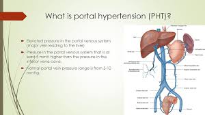 Portal hypertension refers to an increase in blood pressure inside the portal vein that occurs due to liver damage. Portal Hypertension And Common Surgical Diseases Of The Liver Ppt Download