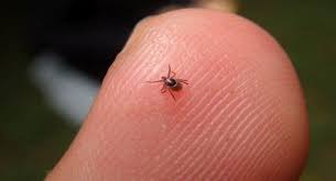 Typhus-Causes-Symptoms-Diagnosis-Treatment | Homeopathic | Best Homeopathic Doctor in Pakistan | Dr Qaisar Ahmed MD, DHMS