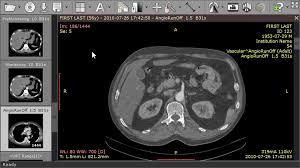 Dicom is an acronym for digital imaging and communication in medicine, and it's a powerful free medical software that media freeware developed for windows devices. Top 25 Free Dicom Viewers For Doctors Medical Students And Health Professionals Postdicom