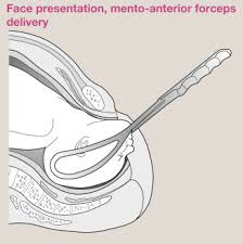 Image result for Face Presentation