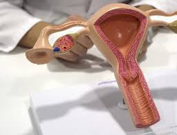 Como Diferenciar El Sangrado Por Implantacion De La Regla Vita Medicina Reproductiva