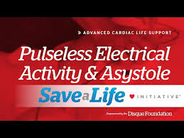 Image result for Pulseless Electrical Activity