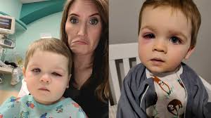 Get it as soon as wed, jul 21. Mom Warns About Hidden Bath Toy Danger After Toddler Nearly Loses His Vision Cafemom Com