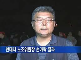 블라인드 | 주식·투자: 손가락 자른 현대차 노조 위원장 근황 - Blind