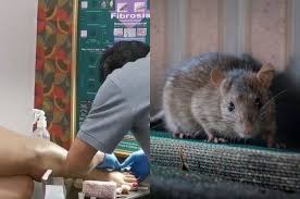 Mau sholat banyak tapi gak diterima allah cuma gara gara sarung yang dipakai kena kencing tikus? Jari Kaki Wanita Ini Digigit Tikus Saat Sedang Nonton Di Bioskop Hingga Berdarah Gigitan Tikus Bisa Berisiko Terkena Penyakit Mematikan Ini Semua Halaman Hype