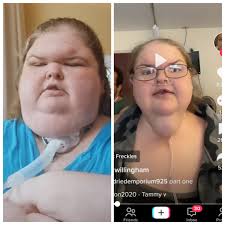 When you do side by side. Series 4 ep 2 VS latest tiktok. Massive  difference! : r/1000lbsisters