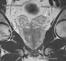 Image result for Seminal Vesicle