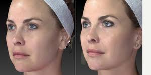 Benjamin Caughlin, MD, FACS Reviews, Before and After Photos, Answers