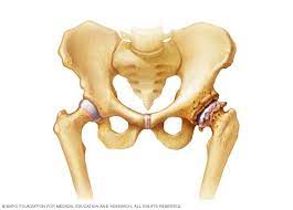 A bone spur, also called an osteophyte, is a smooth, bony lump that grows off a bone. Bone Spurs Symptoms And Causes Mayo Clinic