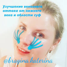 опухла щека от зуба что делать в домашних условиях Oteki Meshki Pod Glazami Sufy Eto Narushenie Ottoka Mezhtkanevoj Zhidkosti Ot Oblasti Glaz Prichin Mozhet Byt Smile Wrinkles Kinesiology Taping Massage Therapy